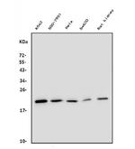 DHFR Antibody in Western Blot (WB)