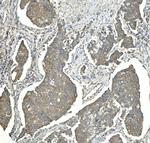 EEF2 Antibody in Immunohistochemistry (Paraffin) (IHC (P))