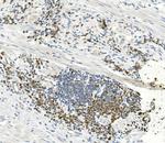 EEF2 Antibody in Immunohistochemistry (Paraffin) (IHC (P))