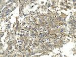 EEF2 Antibody in Immunohistochemistry (Paraffin) (IHC (P))