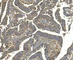 EEF2 Antibody in Immunohistochemistry (Paraffin) (IHC (P))