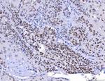 YY1 Antibody in Immunohistochemistry (Paraffin) (IHC (P))