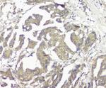 GNAQ Antibody in Immunohistochemistry (Paraffin) (IHC (P))