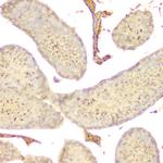 GNAQ Antibody in Immunohistochemistry (Paraffin) (IHC (P))