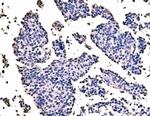 SF1 Antibody in Immunohistochemistry (Paraffin) (IHC (P))