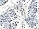 SF1 Antibody in Immunohistochemistry (Paraffin) (IHC (P))