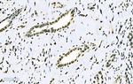 SF1 Antibody in Immunohistochemistry (Paraffin) (IHC (P))