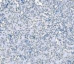 SF1 Antibody in Immunohistochemistry (Paraffin) (IHC (P))