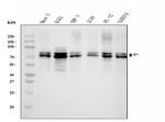 SF1 Antibody in Western Blot (WB)