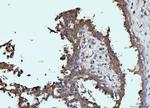 Glutaminase Antibody in Immunohistochemistry (Paraffin) (IHC (P))