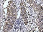 Glutaminase Antibody in Immunohistochemistry (Paraffin) (IHC (P))