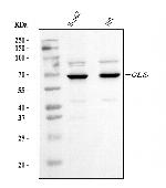 Glutaminase Antibody in Western Blot (WB)