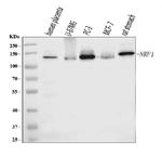 Neuropilin 1 Antibody in Western Blot (WB)