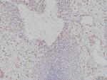 RAB11A Antibody in Immunohistochemistry (Paraffin) (IHC (P))