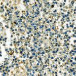 HK1 Antibody in Immunohistochemistry (Paraffin) (IHC (P))