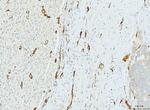 FABP4 Antibody in Immunohistochemistry (Paraffin) (IHC (P))