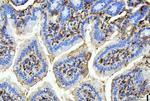 FABP4 Antibody in Immunohistochemistry (Paraffin) (IHC (P))