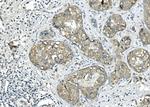 BUBR1 Antibody in Immunohistochemistry (Paraffin) (IHC (P))