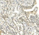 BUBR1 Antibody in Immunohistochemistry (Paraffin) (IHC (P))