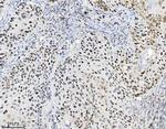 MCM7 Antibody in Immunohistochemistry (Paraffin) (IHC (P))