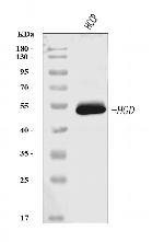 HGD Antibody in Western Blot (WB)