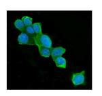 ATP Citrate Lyase Antibody in Immunocytochemistry (ICC/IF)