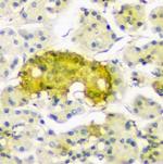 ATP Citrate Lyase Antibody in Immunohistochemistry (Paraffin) (IHC (P))