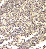 ATP Citrate Lyase Antibody in Immunohistochemistry (Paraffin) (IHC (P))