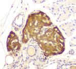 ATP Citrate Lyase Antibody in Immunohistochemistry (Paraffin) (IHC (P))