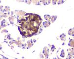 ATP Citrate Lyase Antibody in Immunohistochemistry (Paraffin) (IHC (P))