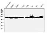 ATP Citrate Lyase Antibody in Western Blot (WB)