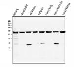 ATP Citrate Lyase Antibody in Western Blot (WB)