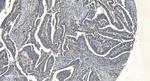 APPL1 Antibody in Immunohistochemistry (Paraffin) (IHC (P))