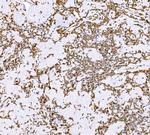 SND1 Antibody in Immunohistochemistry (Paraffin) (IHC (P))