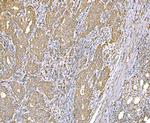 SND1 Antibody in Immunohistochemistry (Paraffin) (IHC (P))