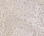 SND1 Antibody in Immunohistochemistry (Paraffin) (IHC (P))