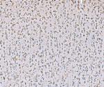 SND1 Antibody in Immunohistochemistry (Paraffin) (IHC (P))