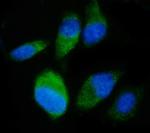 SND1 Antibody in Immunocytochemistry (ICC/IF)