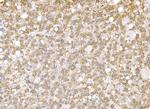 SND1 Antibody in Immunohistochemistry (Paraffin) (IHC (P))