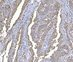 SND1 Antibody in Immunohistochemistry (Paraffin) (IHC (P))