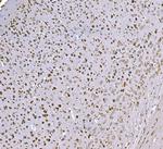 SND1 Antibody in Immunohistochemistry (Paraffin) (IHC (P))