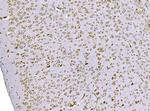 SND1 Antibody in Immunohistochemistry (Paraffin) (IHC (P))