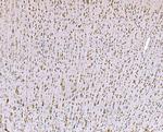 SND1 Antibody in Immunohistochemistry (Paraffin) (IHC (P))