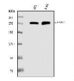 Ankyrin 1 Antibody in Western Blot (WB)