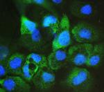 AIP Antibody in Immunocytochemistry (ICC/IF)