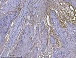 ILK Antibody in Immunohistochemistry (Paraffin) (IHC (P))