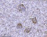 ILK Antibody in Immunohistochemistry (Paraffin) (IHC (P))