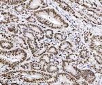 TRIM24 Antibody in Immunohistochemistry (Paraffin) (IHC (P))