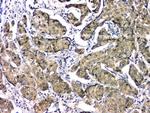 eIF6 Antibody in Immunohistochemistry (Paraffin) (IHC (P))