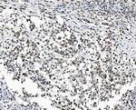 DDX1 Antibody in Immunohistochemistry (Paraffin) (IHC (P))